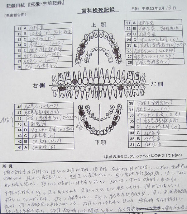 遺体安置所で作成されたデンタルチャート（提供：斉藤久子氏）