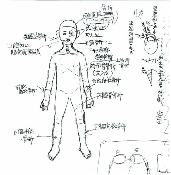 父親で外科医の緒方さんによる当日のメモ（筆者撮影）