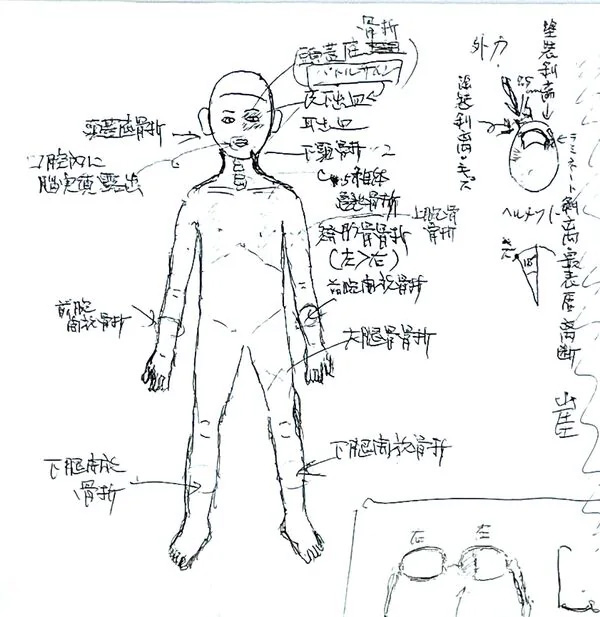 医師である緒方節男さんが描いた息子・禎三さんの遺体の損傷図