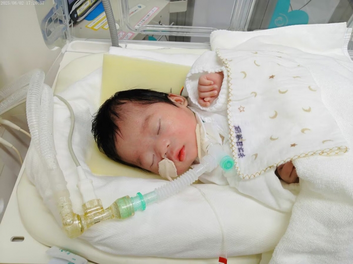 日七未ちゃんは人工呼吸器を装着し、今もベッドで眠ったままだ（家族提供）