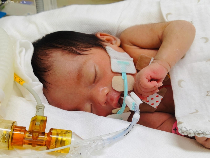 気管切開を受ける前の、生後間もない日七未ちゃん(家族提供)