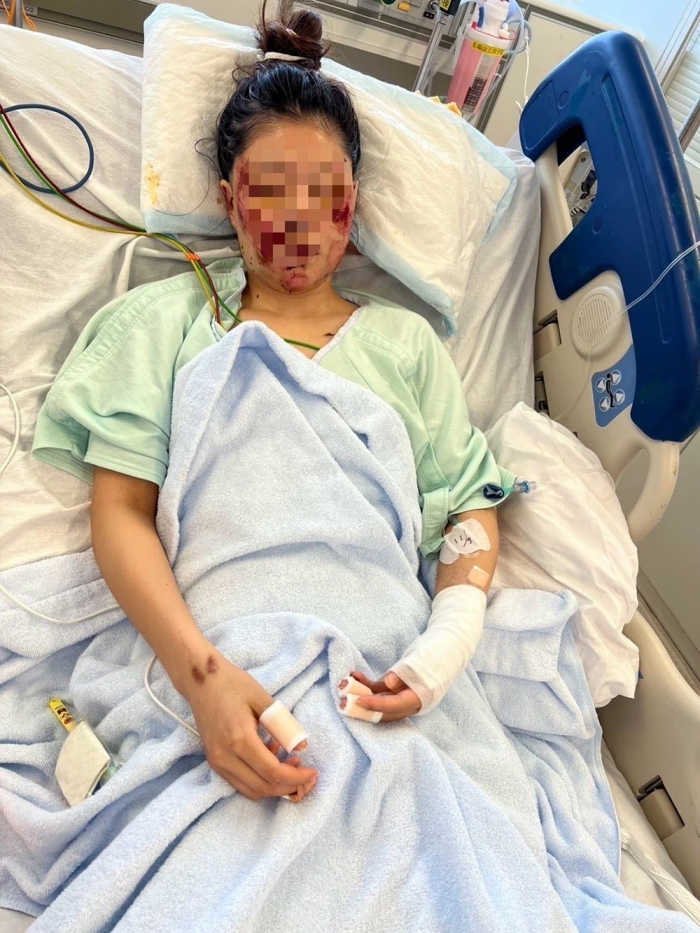 ひき逃げ事故に遭い、病院で治療中の高橋琴さん(仮名)