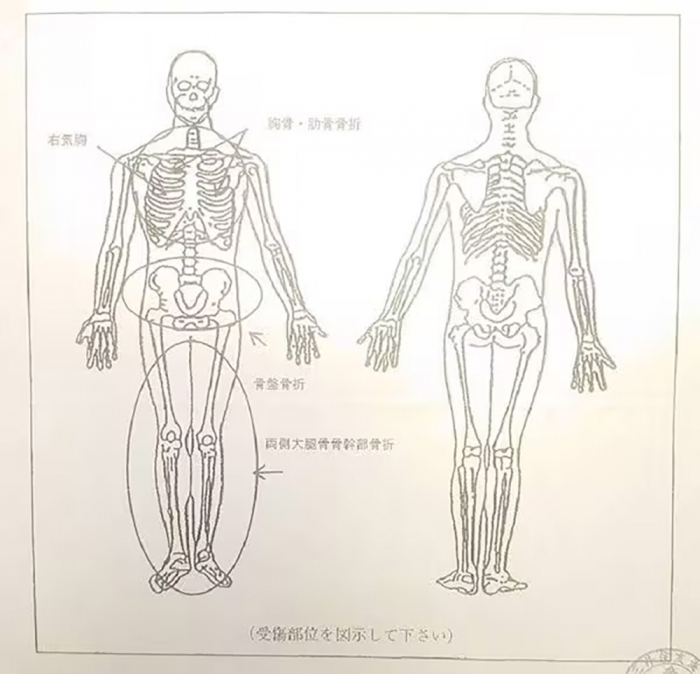 亡くなった小柳さんの死亡診断書（遺族提供）